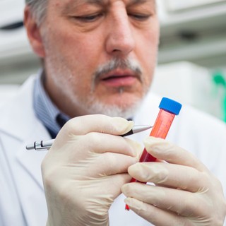 Bajt jelent, ha ezt kimutatják a vérben: a tudósok egy korai Parkinson-kór jelet találtak című cikk nyitóképe