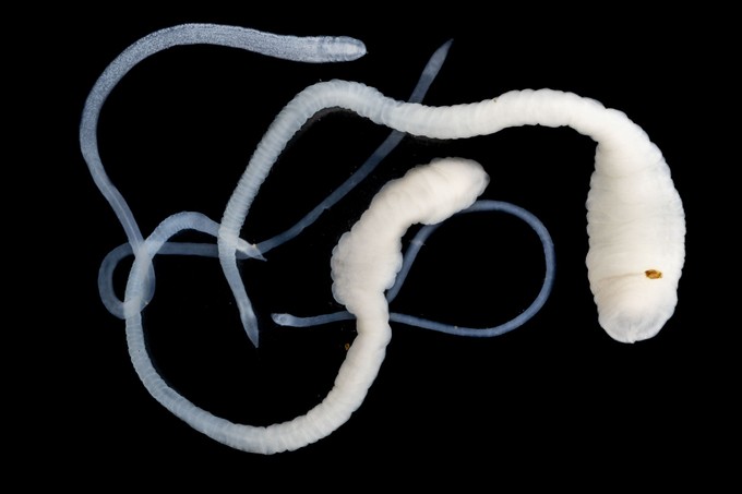 Ezek a tünetek jelezhetik azt, hogy galandféreg él a szervezetében című cikk nyitóképe