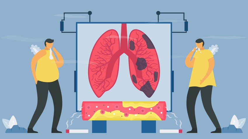  A köhögés több fajta lehet: száraz, ugató, vagy produktív, köpetürítéssel járó. A köpet színe gyulladások esetén sárgássá-zöldessé változik, asztma esetén tapadós, üvegszerű.