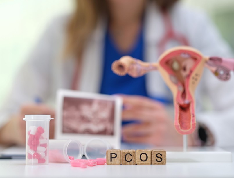 pcos hogyan gyógyítható