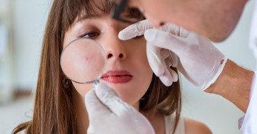  Így jelzi a bőre a vitaminhiányt 