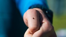 A Hyalomma kullancsok áttelelhetnek Magyarországon? Az idei észlelések nem sok jóval kecsegtetnek című cikk nyitóképe