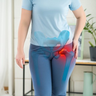 Sok nő nem is tudja, hogy ezzel küzd, mivel nem járnak el a szűrésére című cikk nyitóképe