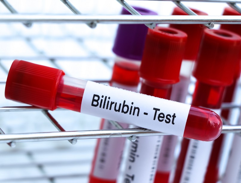 Mit jelent bilirubin érték laborlelet