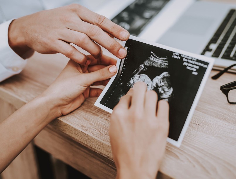 várandósság terhesség köldökzsinór orvos válaszol