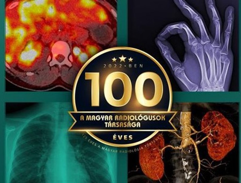 röntgen, radiológia, röntgensugár, X-sugárzás, Nobel-díj