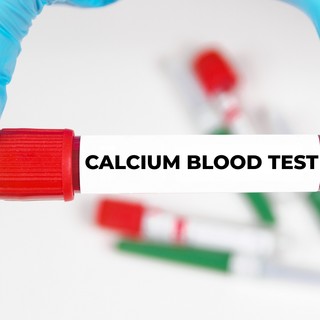Mit jelent a kalcium érték a laborleleten? című cikk nyitóképe