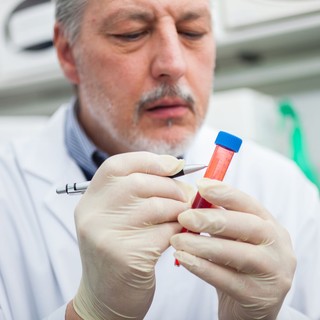 Bajt jelent, ha ezt kimutatják a vérben: a tudósok egy korai Parkinson-kór jelet találtak című cikk nyitóképe