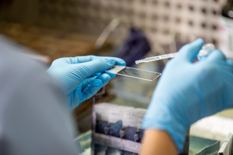 Mi a különbség a koronavírus-tesztek között, melyik a megbízható?