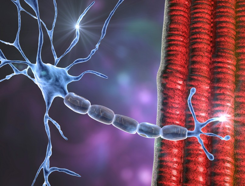 Duchenne izomdisztrófia