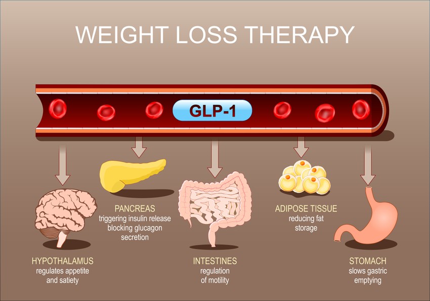 A GLP-1 tabletták (GLP-1 receptor agonisták) olyan receptköteles gyógyszerek, amelyek a bélben termelődő hormon hatását utánozva csökkentik az étvágyat, lassítják a gyomor kiürülését és stabilizálják a vércukorszintet. Hatékonyak a testsúlycsökkentésben és a 2-es típusú cukorbetegség kezelésében, tabletta formában is elérhetők. A GLP-1 alapú gyógyszerek kizárólag szakorvosi (diabetológus, endokrinológus) javaslatra és szoros orvosi felügyelet mellett alkalmazhatók a 2-es típusú cukorbetegség vagy elhízás kezelésére.
