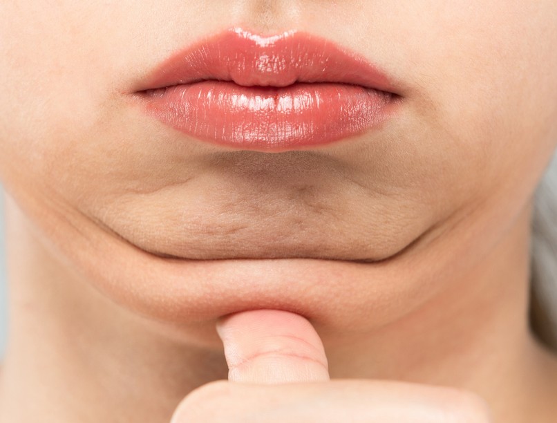 Mitől alakul ki a toka