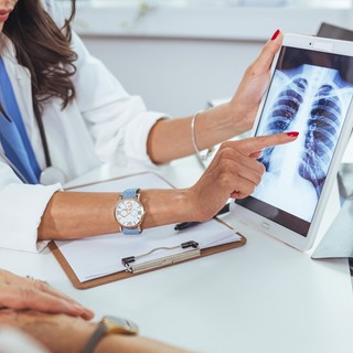 Hogyan gyógyul a tüdő, és miként segíthetjük a gyógyulását? című cikk nyitóképe