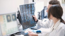 PTE-kutatás: közelebb kerülhetünk az epilepszia és a Parkinson-kór pontosabb felismeréséhez című cikk nyitóképe