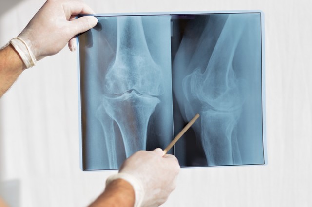 Ultramodern röntgenkészülék a pécsi belgyógyászati klinikán