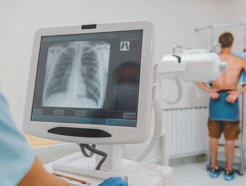 tüdőrákszűrő nap országos korányi pulmonológiai intézet