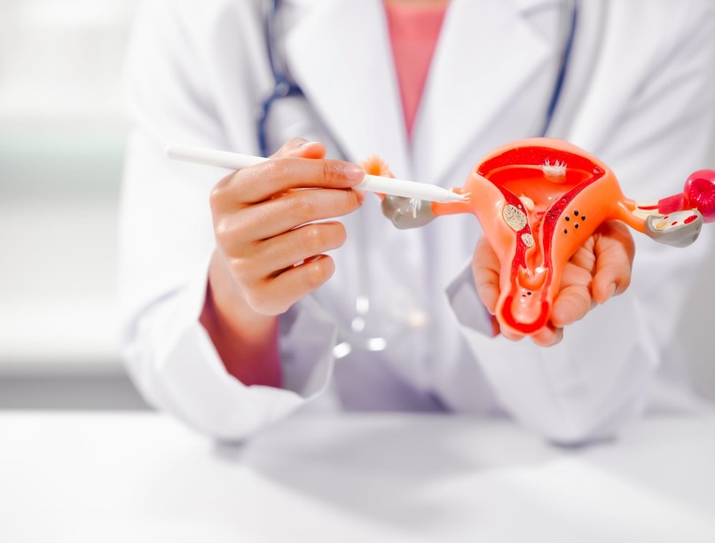 PCOS, tünetei, kezelése, autiumus, várandóság, meddósség