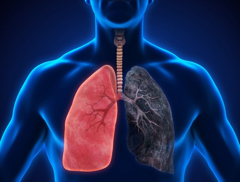 COPD tüdő dohányzás cigaretta WHO