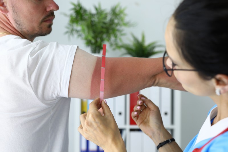 6 tanács a bőrgyógyásztól - így védekezzen a nap káros sugarai ellen