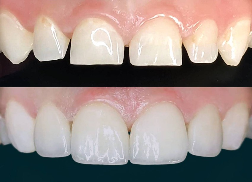 Így nyerje vissza életminőségét: fogászati újdonságok 2026-ban (x)