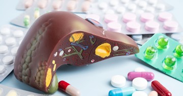  Zsírmáj ellen tényleg tehetünk valamit gyógynövényekkel, vagy sem? 