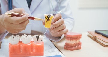 Többet számít, mint a fogmosás? Ezek az ételek kiirtják a rossz baktériumokat a szájból