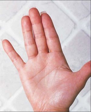 Emlő önvizsgálat 10