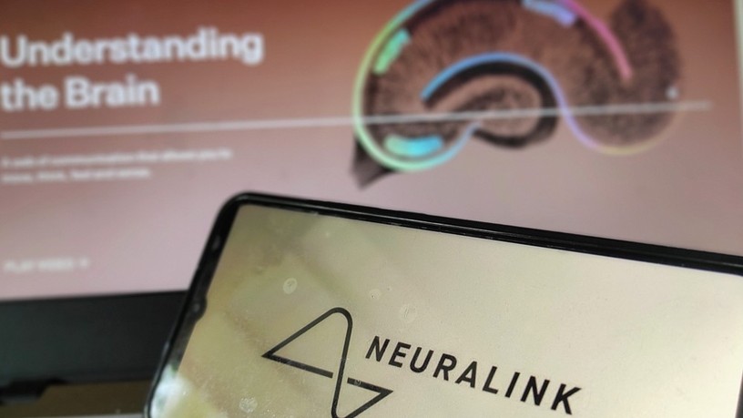 agyi  chip beültetés neuralink