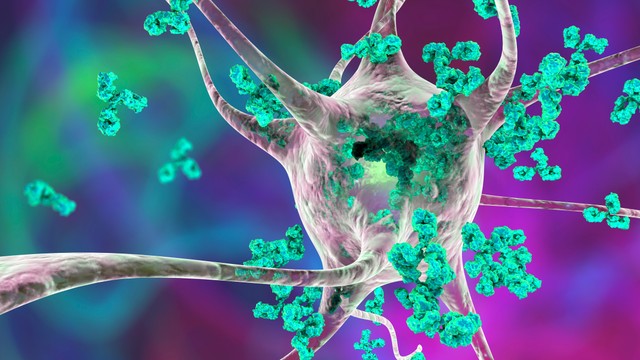 Ezzel a súlyos, gyógyíthatatlan betegséggel küzd Putyin egykori főtanácsadója