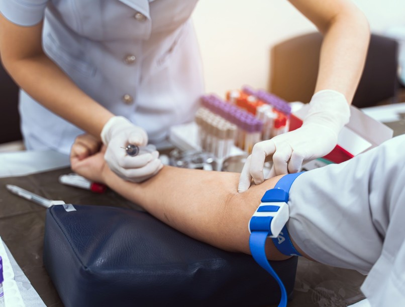 vérvétel előtt lehet edzeni laboreredmény