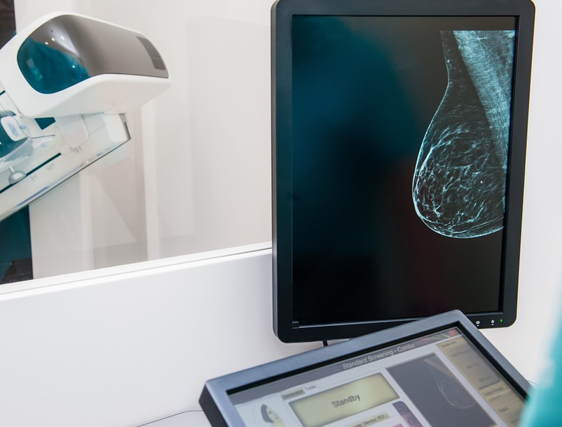 mellrák, emlőrák, önvizsgálat, mammográfia, emlőszűrés, röntgenmammográfia, Mellrák megelőzés hónapja