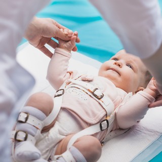 Veleszületett csípőficam tünetei, vizsgálata és kezelése című cikk nyitóképe