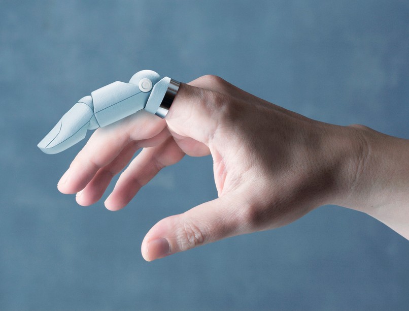 protézis behelyezés protetika kezelés leírás