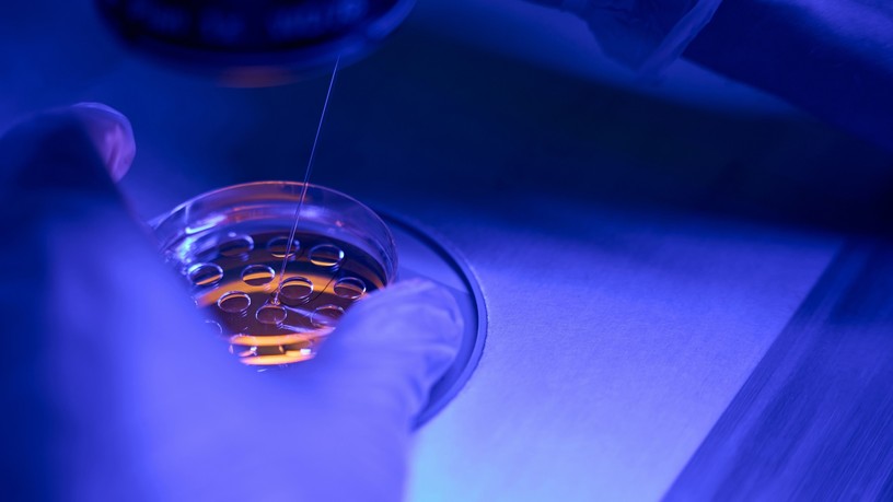 mire jó biopszia menete rák elváltozás tumor jele