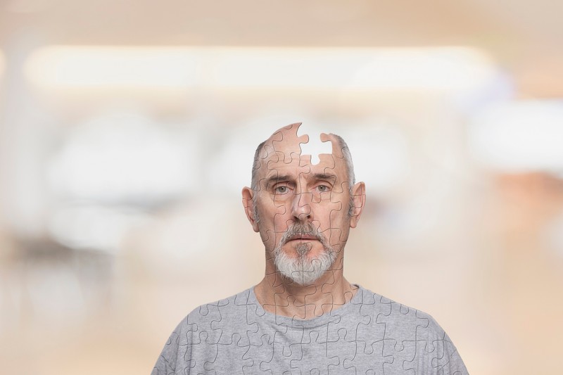 Paradigmaváltás az Alzheimer-kór kapcsán: új formát és okot azonosítottak a tudósok