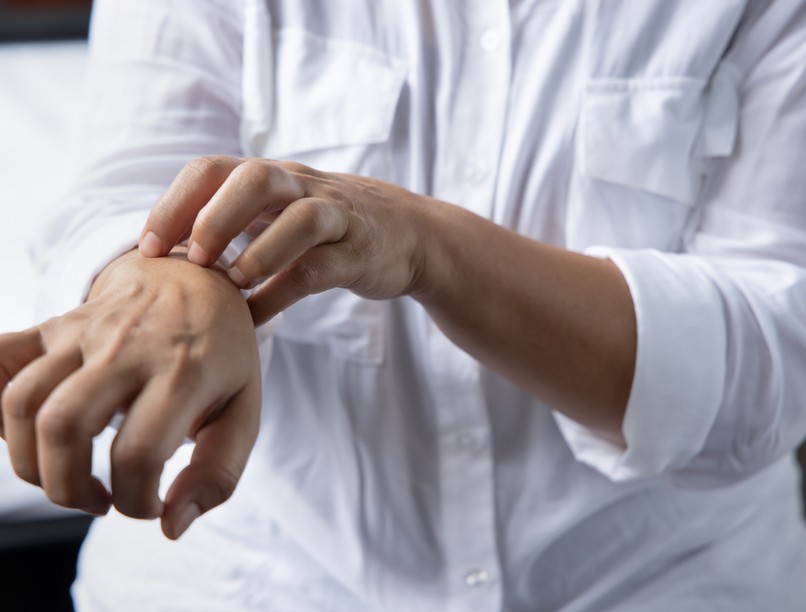 viszketés, allergia, hisztamin, intolerancia