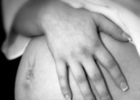 Terhességvállalás PCOS mellett is?