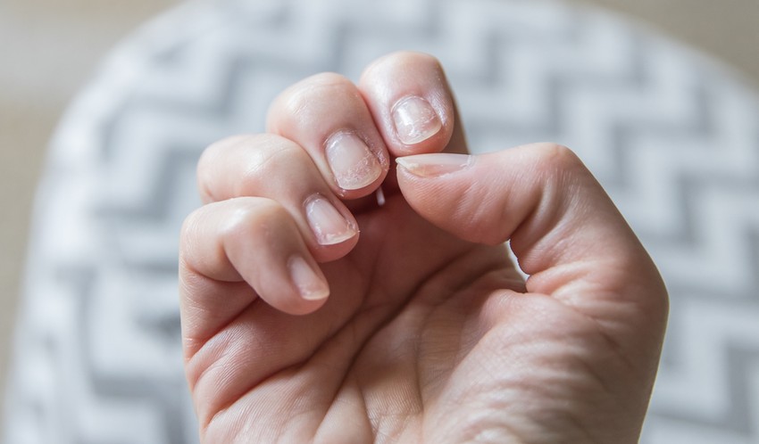 A körmök egészsége szempontjából is megkerülhetetlen anyag a cink.