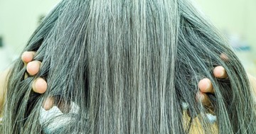 Meglepő felfedezés: az őszülés lehet a szervezet rákellenes védelmi reakciója