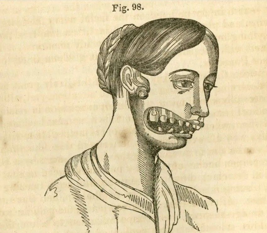 Ezek az emberek, ahogy azt az írás is mutatja, szörnyű fájdalmak között haltak meg, miközben a gyár vezetősége nem vett tudomást a munkakörülmények miatt kialakult borzasztó betegségről, amelyben sokan bele is haltak. 