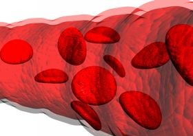 Koszorúér-betegség - és az Alzheimer-kór összefüggése