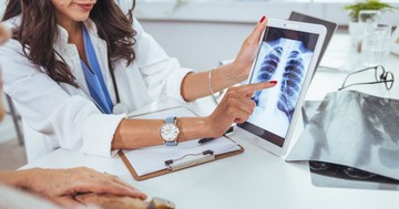  Hogyan gyógyul a tüdő, és miként segíthetjük a gyógyulását? 