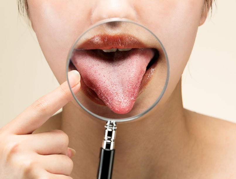 daganatos betegségek nyelvrák tünet kezelés