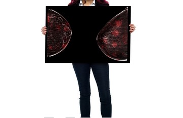 Nem ellentmondás, csak rosszul tudja: 12 tévhit az emlőrákkal kapcsolatban