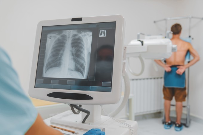 Tüdőrákszűrő napot szervez szombatra az Országos Korányi Pulmonológiai Intézet című cikk nyitóképe