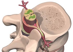 A gerincvelő sérülésének megelőzése