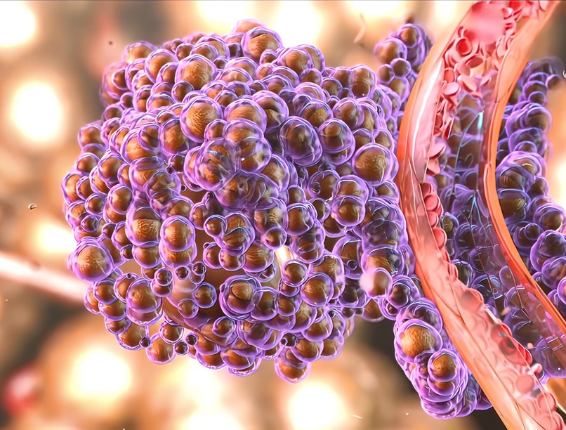 alkohol vastagbélrák halálozási mutató