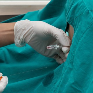 Mi a lumbálpunkció és mit mutat ki? című cikk nyitóképe