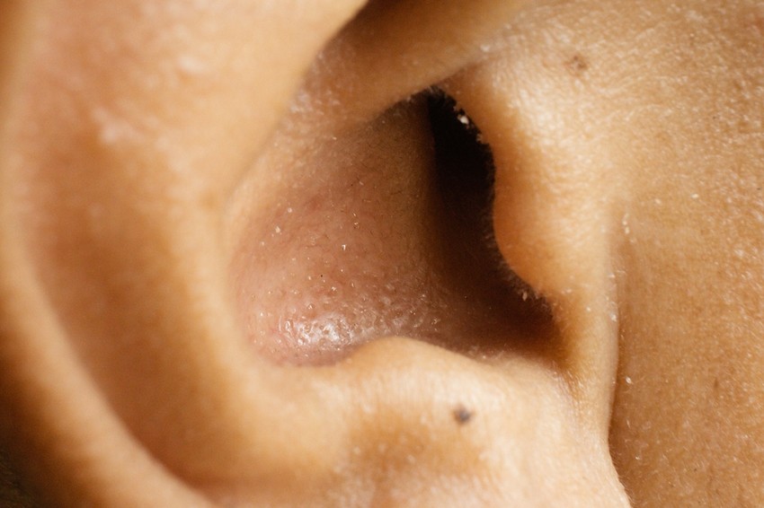 A nagy nyári melegben természetes, hogy mindenki jobban verejtékezik, mint szokott. Gyanússá ekkor kell váljon a dolog.