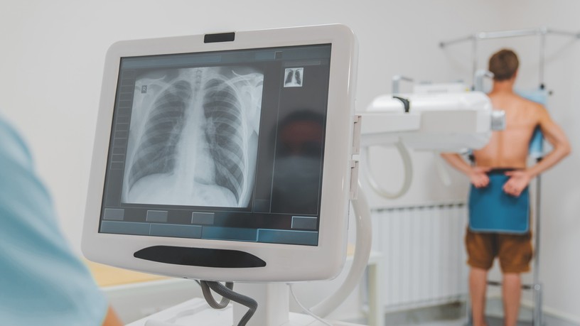 tüdőrákszűrő nap országos korányi pulmonológiai intézet